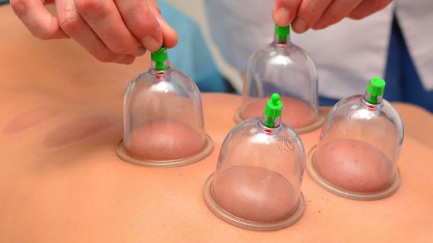 _1940_Mengenal-Terapi-Bekam-dan-Manfaatnya-Bagi-Kesehatan